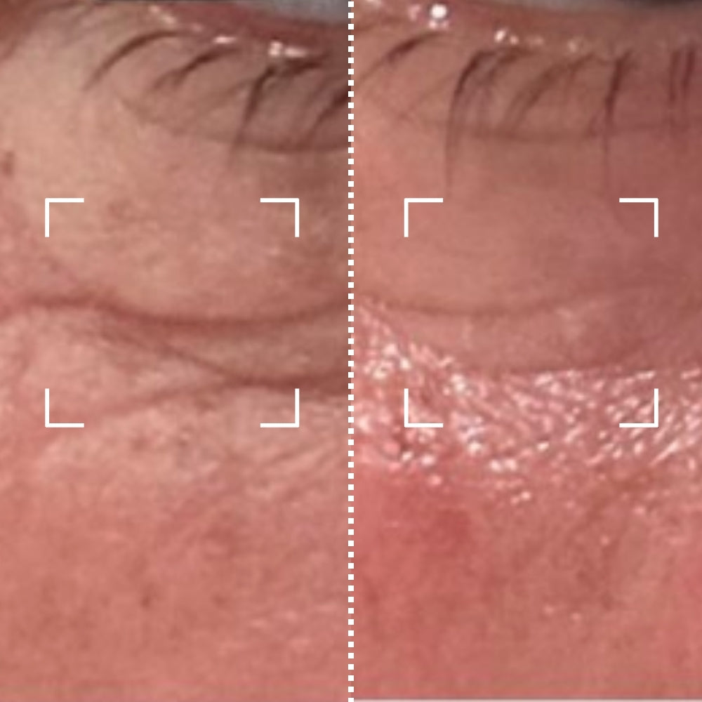 Before & After