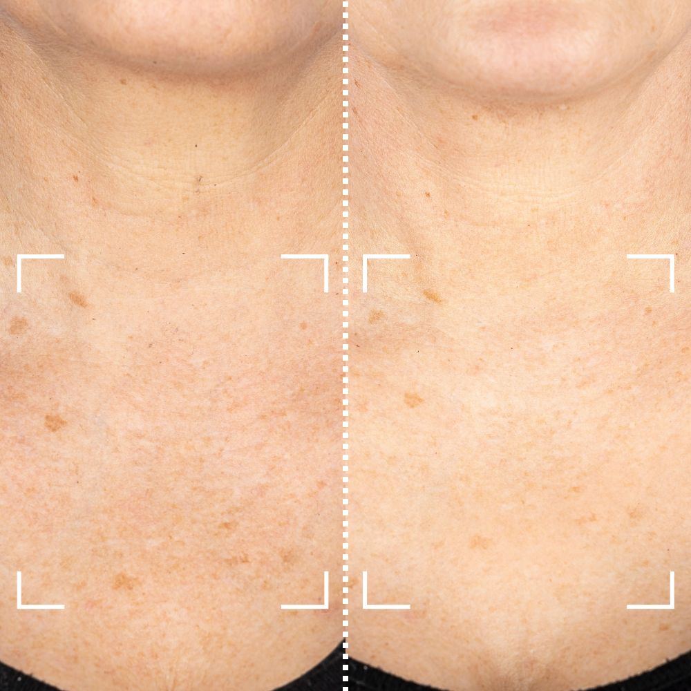 Before & After