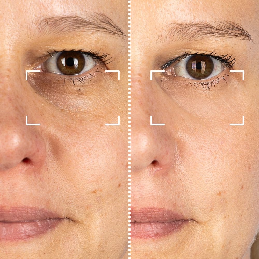 Before & After