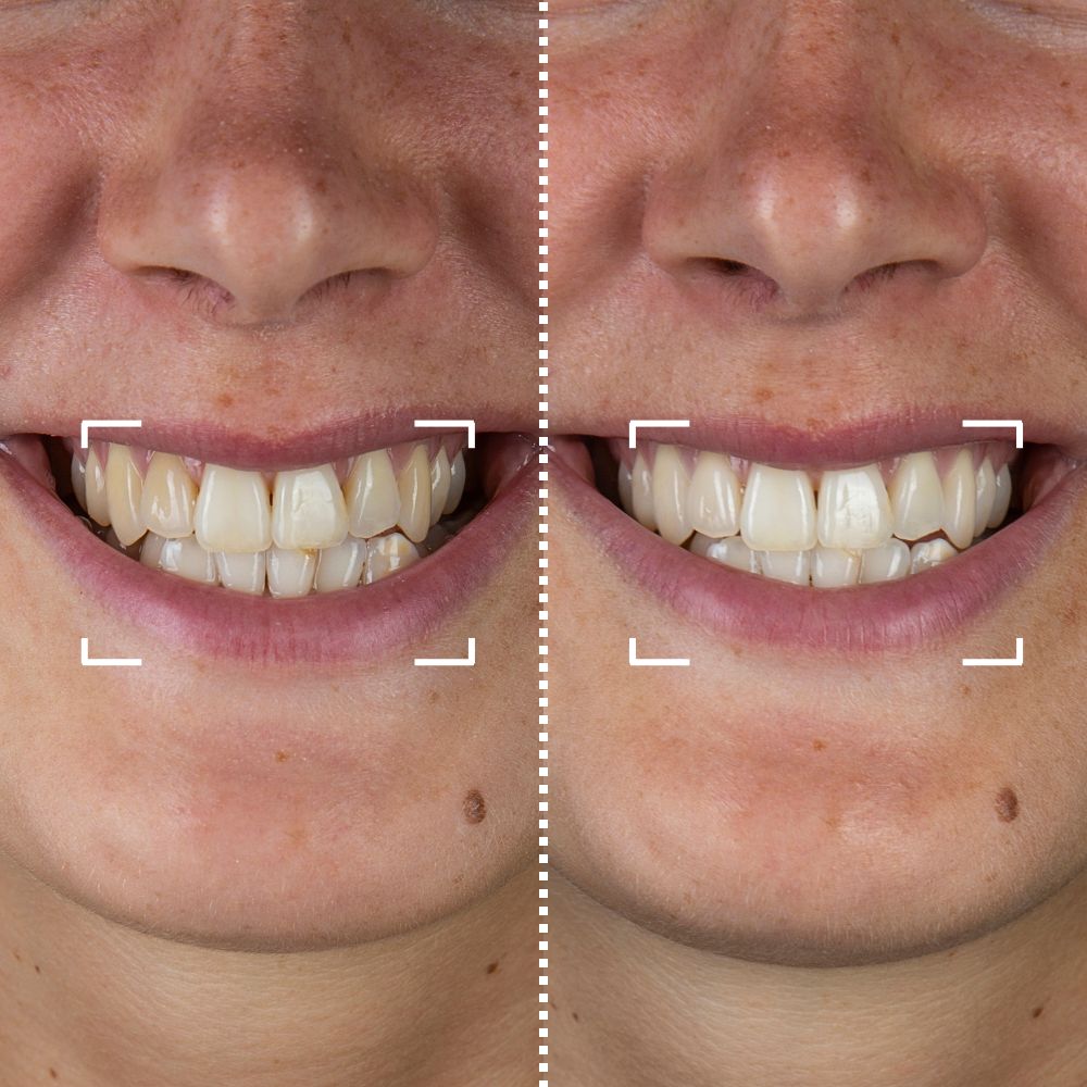 Before & After