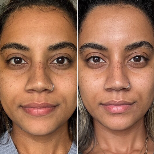 Before & After