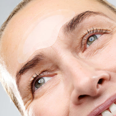 Forehead Microneedling Patch (8 week starter kit)